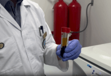 Nueva prueba permite detectar nueve tipos de cáncer con una muestra de sangre en Costa Rica